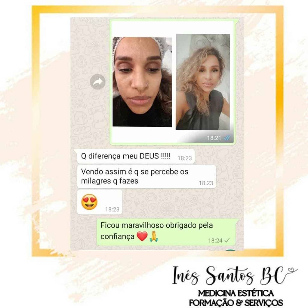 feedback cliente medicina estética beauty center saúde feedback cliente medicina estética beauty center saúde